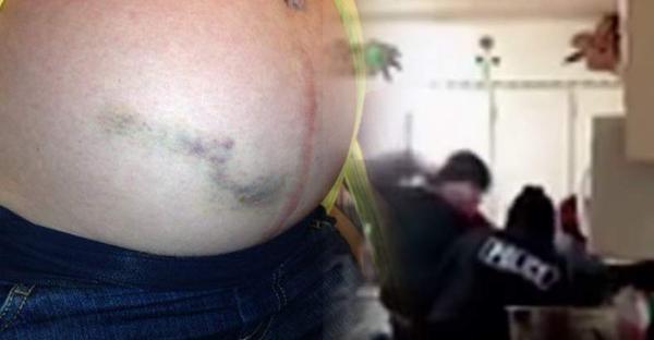 #PoliceBrutality Tweets 9.2