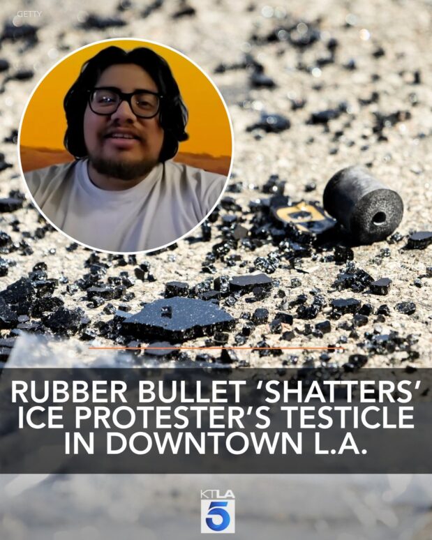 A man who was out protesting against ICE raids in downtown Los Angeles this week spoke with KTLA after an officer’s close-range shot to his groin with a rubber bullet severely bruised one of his testicles… and “shattered” the other.